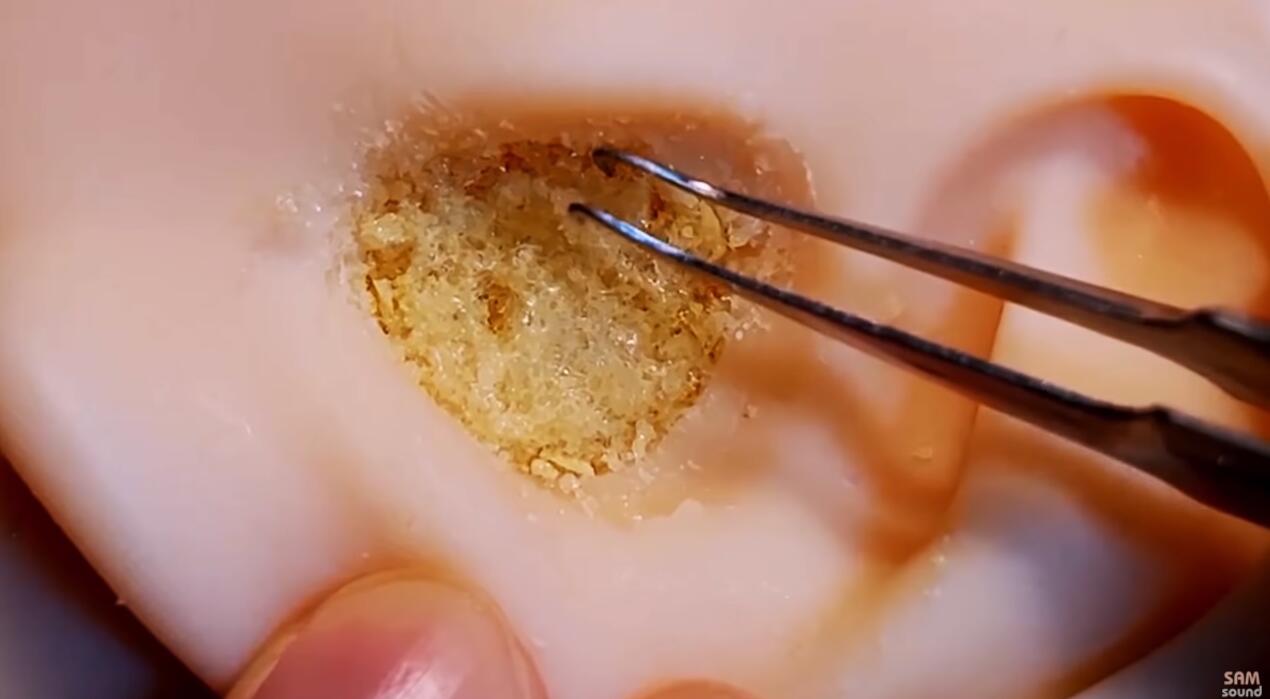 老司机解除免疫 挠破的快感!!掏空堵塞的耳洞挖耳朵SAM sound插图 老司机解除免疫 挠破的快感!!掏空堵塞的耳洞挖耳朵SAM sound插图