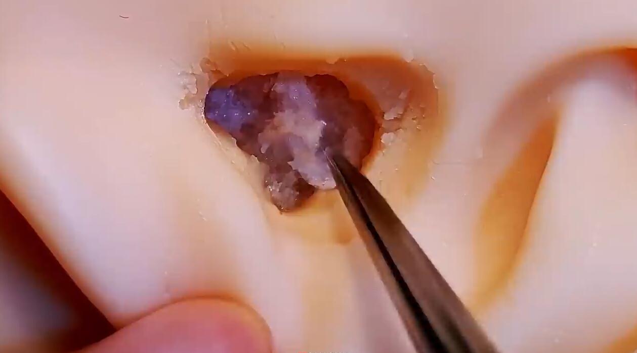 水晶史莱姆掏耳 深度耳垢清洁 在耳朵里踩雪的那种感觉插图 水晶史莱姆掏耳 深度耳垢清洁 在耳朵里踩雪的那种感觉插图