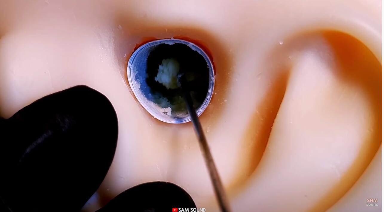 强力耳朵清洁 去除像奶油一样柔软的耳屎,挖耳屎插图 强力耳朵清洁 去除像奶油一样柔软的耳屎,挖耳屎插图