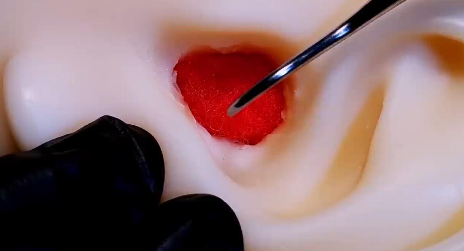 SAM ASMR 模拟深度耳朵清洁 清除超大的耳垢插图 SAM ASMR 模拟深度耳朵清洁 清除超大的耳垢插图