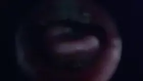 布鲁比呐呐_鱼眼镜头鱼眼镜头_3_1-助眠音声网
